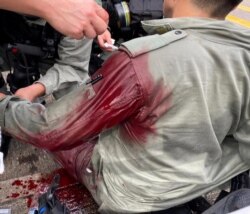 在香港主权移交中国纪念日当天港人游行反对港版国安法期间一名港警受伤。(2020年7月1日)